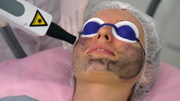 Carbon Face Peeling Verfahren Laserpulse Reinigen Die Gesichtshaut Kosmetische Hardware — Stockvideo