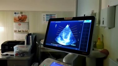 ekran ultrason makinesi. sağlık hizmetlerinde sembolü tanılama.