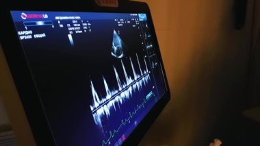 ekran ultrason makinesi. sağlık hizmetlerinde sembolü tanılama.