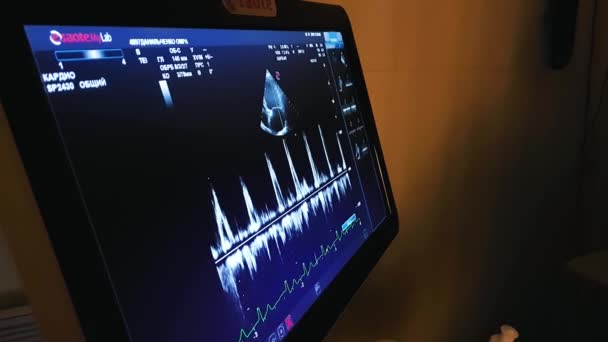 Máquina de ultrasonido de pantalla. diagnósticos de símbolo en la atención sanitaria . — Vídeo de stock
