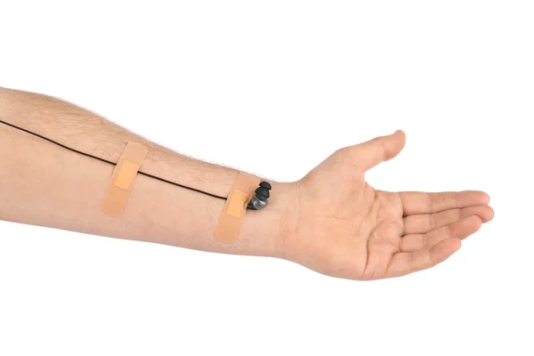 Mano con auricolari come infusione endovenosa medica — Foto Stock