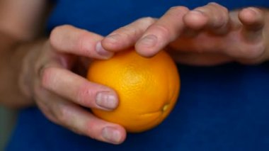 Sedef yaşamalı. Narenciye alerjisi. Eller Close-Up.