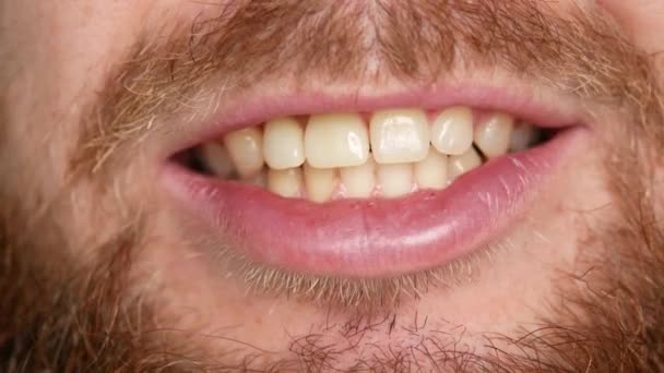 Крупный план рта. Мужчина показывает свой протез — стоковое видео