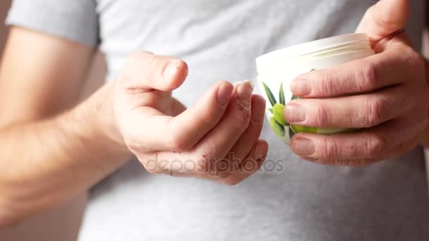 Un hombre unta una mano enferma con crema. Psoriasis y enfermedad de la piel — Vídeos de Stock