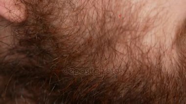 Sakallı bir adam close-up. O kafasını bir çerçeve ve gülümsüyor döner. Çocuklar diş kırılmış