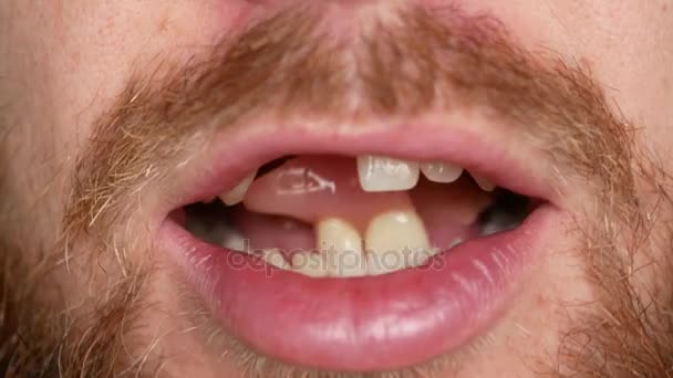 特写的嘴。一个男人展示他的假牙 — 图库视频影像