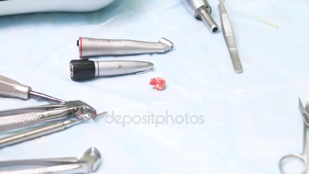 De gescheurde tand ligt op de tafel onder de tandheelkundige instrumenten — Stockvideo
