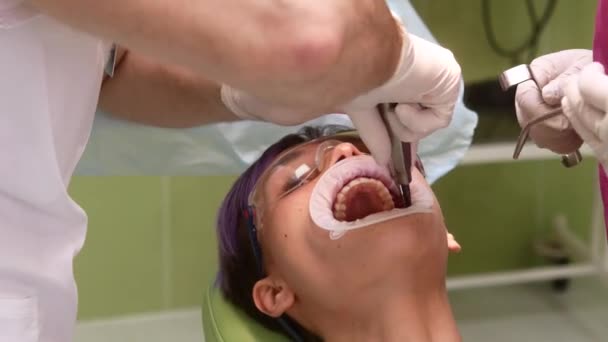 Стоматолог с ассистентом удаляет зуб у молодой женщины — стоковое видео