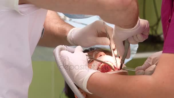 Um dentista com um assistente remove o dente de uma jovem — Vídeo de Stock