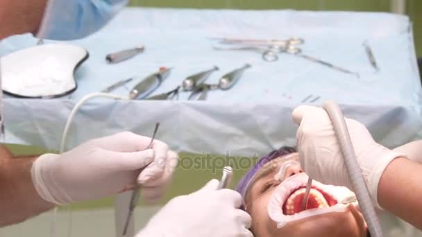 젊은 여자에서 치아를 제거 하는 보조와 치과 의사 — 비디오