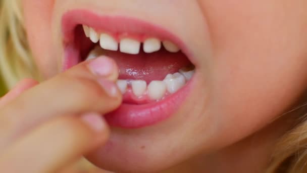 El niño muestra su primer diente asombroso. Dedo afloja dientes babys. — Vídeos de Stock