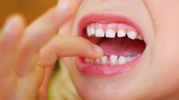 Το παιδί δείχνει το πρώτο του συγκλονιστικό δόντι. Δάχτυλο χαλαρώνει μωρό δόντι. — Αρχείο Βίντεο