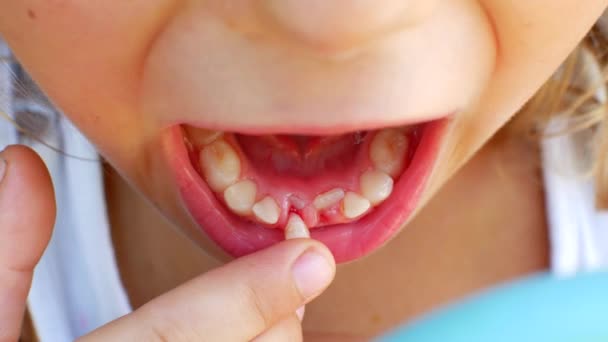 Criança tenta arrancar seu segundo dente com os dedos — Vídeo de Stock