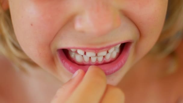 Das Kind zeigt seinen ersten taumelnden Zahn. Finger lockert Babys Zahn.