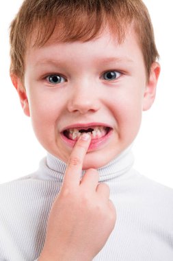 Bebek diş eksikliği gösterilen çocuk 