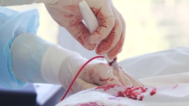 Gehakt Van Handen Van Een Chirurg Medische Endoscopische Chirurgie — Stockvideo