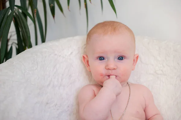 Un enfant atteint de dermatite atopique — Photo