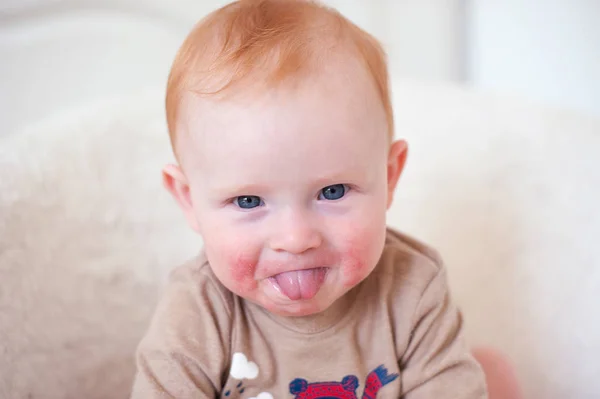 Un niño con alergia — Foto de Stock