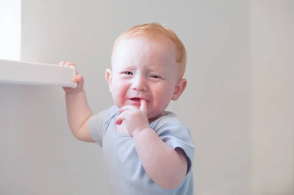 Piangere ragazzo zenzero con dermatite atopica — Foto Stock