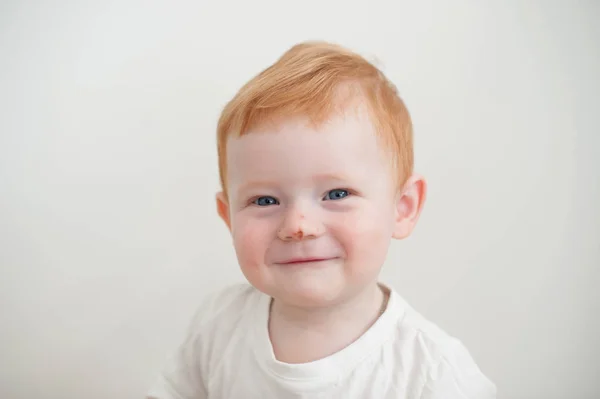 Jongen Met Een Kras Zijn Neus — Stockfoto