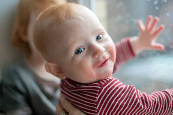 Baby Mit Manifestationen Einer Nahrungsmittelallergie Gesicht — Stockfoto