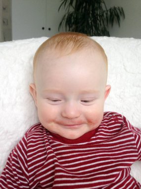 Bebek Anti yüzünde izleri ile