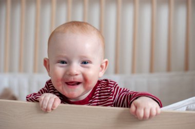 Alerji, bir bebeğin yüzünde Atopik dermatit