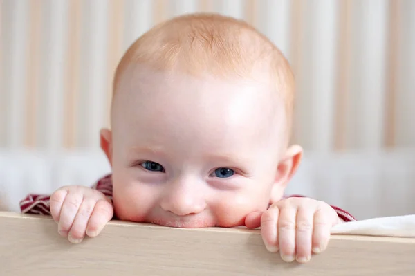 Allergies Atopic Dermatitis Face Baby — Stock Photo, Image