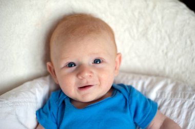 Bebeğin yanaklarda diyatez izleri