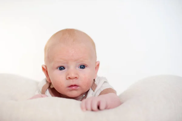 Traces Diathèse Allergies Sur Les Joues Bébé — Photo