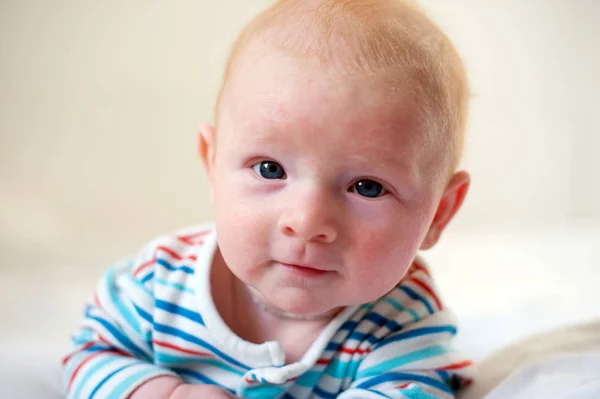 Allergieën Atopische Dermatitis Het Gezicht Van Een Baby — Stockfoto