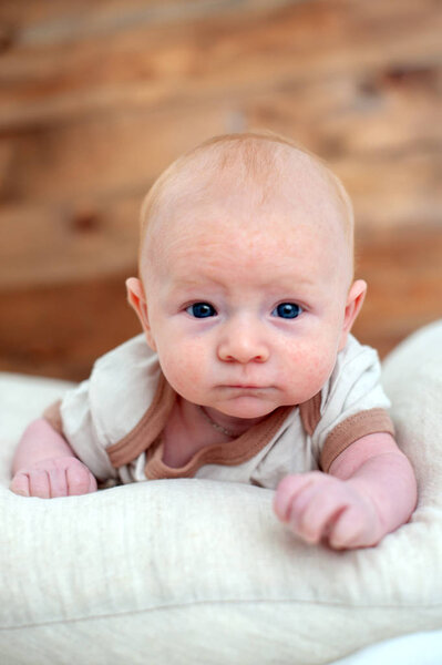 Allergies, atopic dermatitis on the face of a baby