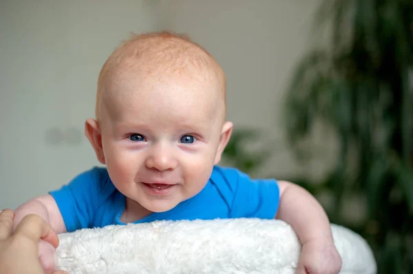 Bambino Con Dermatite Seborroica Sulla Testa Allergia — Foto Stock