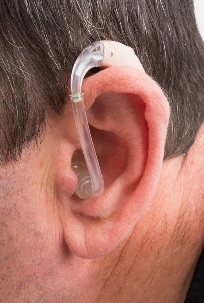 Un audífono moderno en la oreja de un joven europeo . — Foto de Stock
