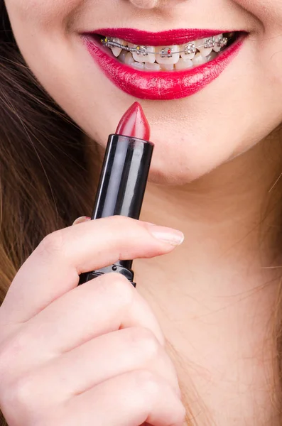 Bocca con parentesi e rossetto rosso — Foto Stock