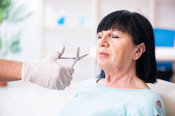 Mulher velha visitando médico masculino para cirurgia plástica — Fotografia de Stock