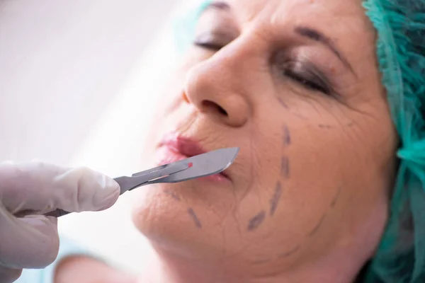 Anciana visitando a médico masculino para cirugía plástica — Foto de Stock