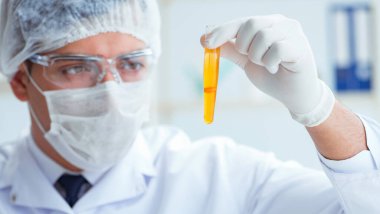 Doktor hastaların idrarını tıbbi amaçlar için test ediyor.