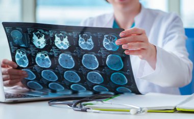 Doktor hastanede MRI görüntüsünü inceliyor.