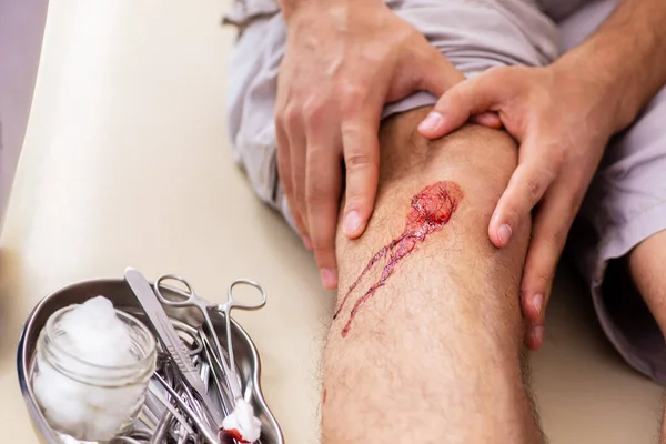 응급 치료 개념으로 노인을 방문하던 다리를 다친 사람 — 스톡 사진