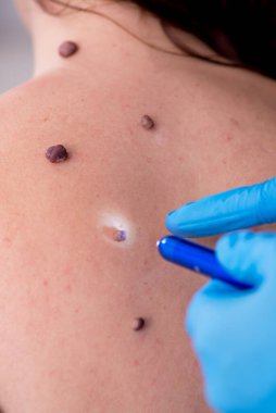 Genç bir kadın erkek doktor dermatoloğunu ziyaret ediyor.