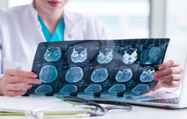 Doktor hastanede MRI görüntüsünü inceliyor.