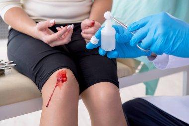 Erkek doktoru ziyaret eden bacağı yaralı bir kadın.
