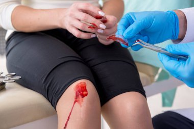 Erkek doktoru ziyaret eden bacağı yaralı bir kadın.