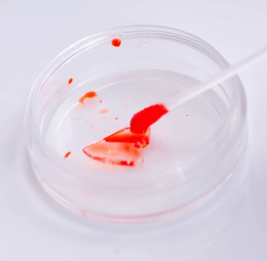 Kan laboratuar testlerini