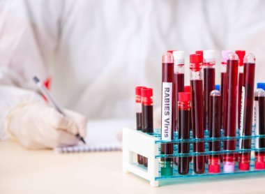 Genç yakışıklı laboratuvar asistanı hastanede kan örnekleri test ediyor.