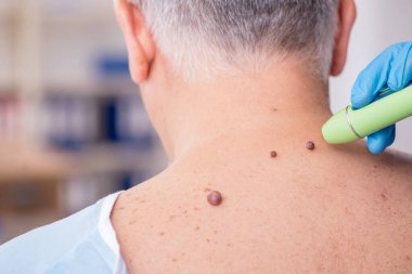 Yaşlı adam genç erkek doktor dermatoloğu ziyaret ediyor.