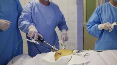 Abdominal organ endoskopik cerrahi sırasında üç doktor vücut parçaları