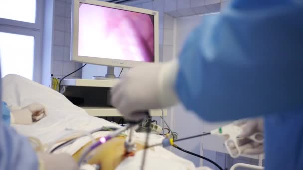 Affichage Montrant Une Chirurgie Endoscopique Dans Organe Abdominal Les Mains — Video