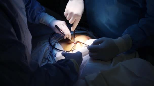 Руки Врачей Зашивающих Слезы После Эндоскопии — стоковое видео